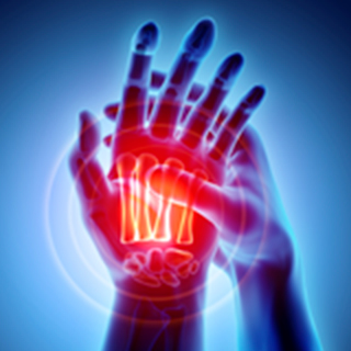 UCSF-Division-of-Rheumatology-Research-2x