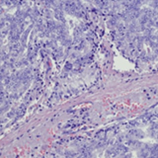 UCSF-Prostate-Cancer-Program-Research-2x