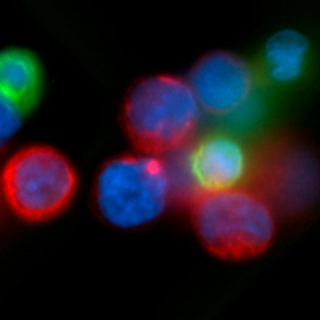 breast-cancer-trials-2x