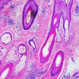 UCSF-Department-of-Dermatology-Research-2x