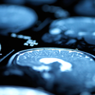 UCSF-Department-of-Radiology-and-Biomedical-Imaging-Research-2x