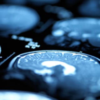 UCSF-Department-of-Radiology-and-Biomedical-Imaging-Research-2x