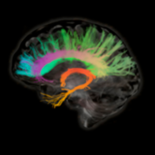 UCSF-Memory-and-Aging-Center-Research-2x