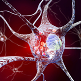 UCSF-Movement-Disorders-and-Neuromodulation-Center-Research-2x