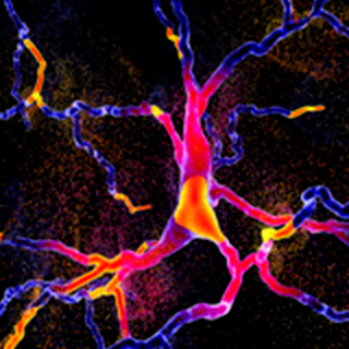 UCSF-Parkinsons-Disease-Clinic-and-Research-Center-2x