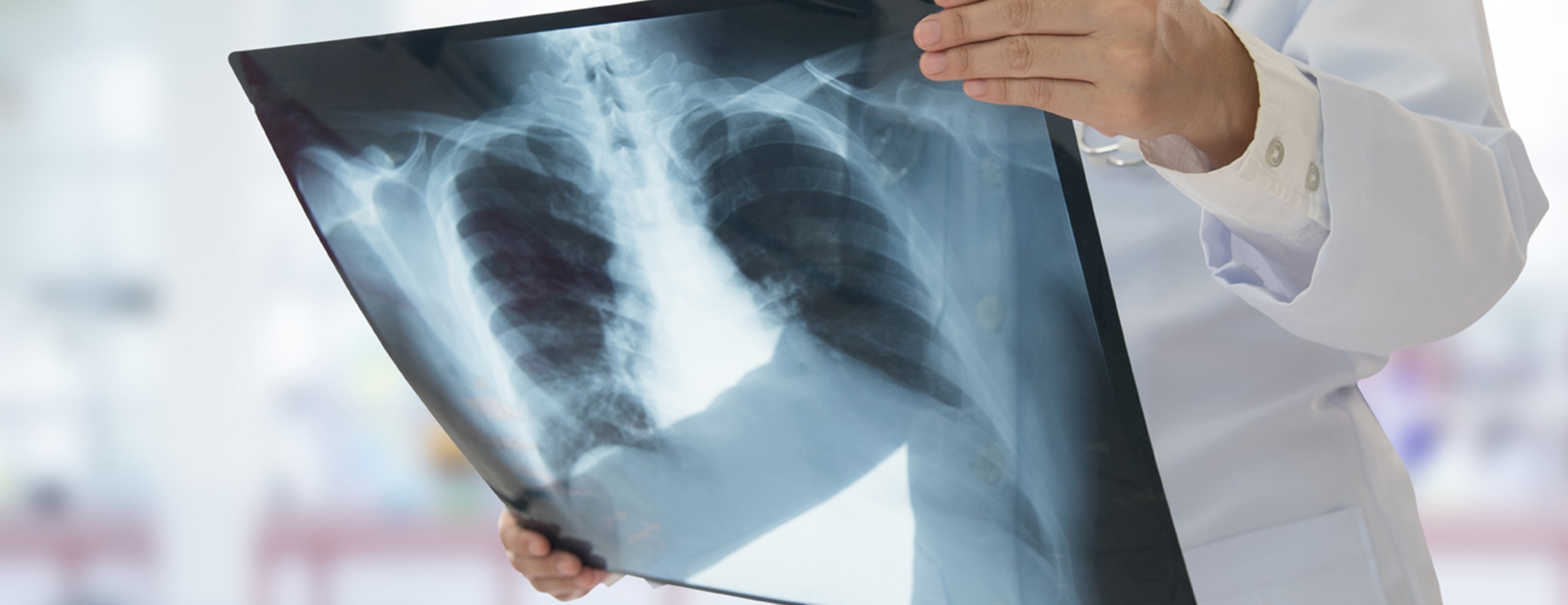 Urgent Care That Does Chest X Rays Near Me Tricheenlight