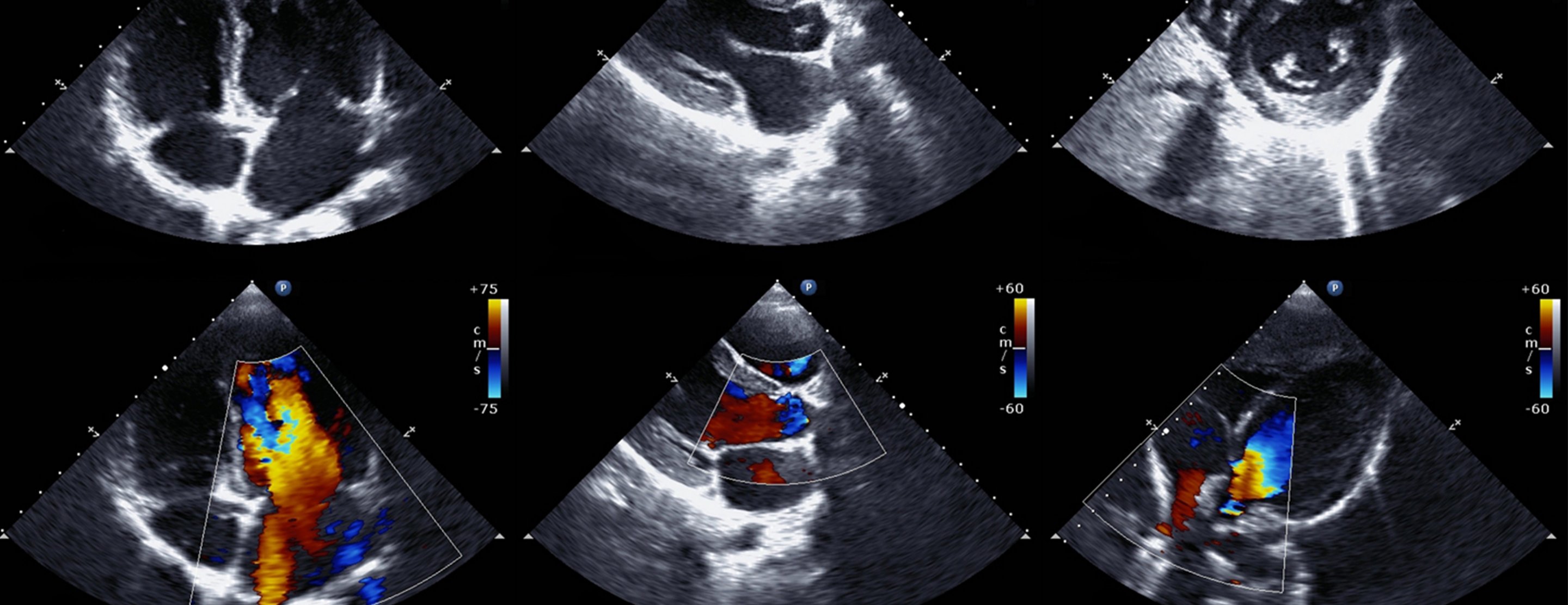 echocardiogram