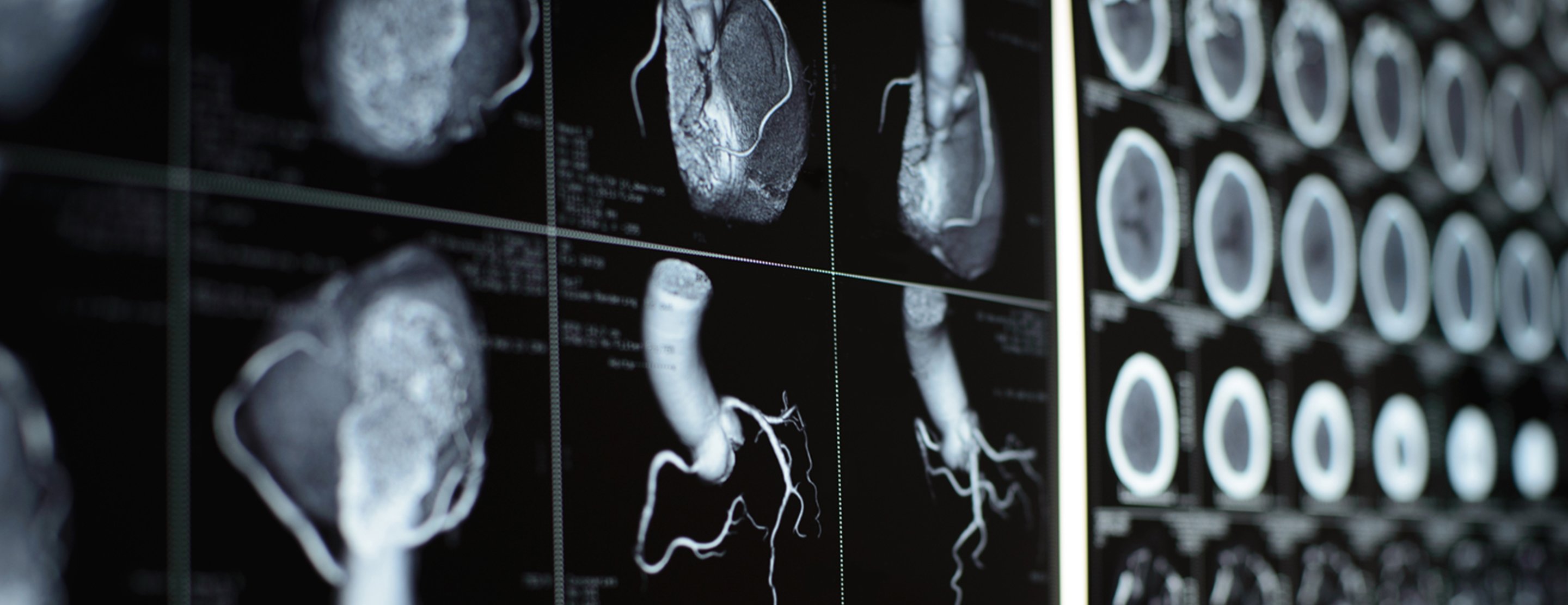 apa-itu-ct-scan-lenggogeni