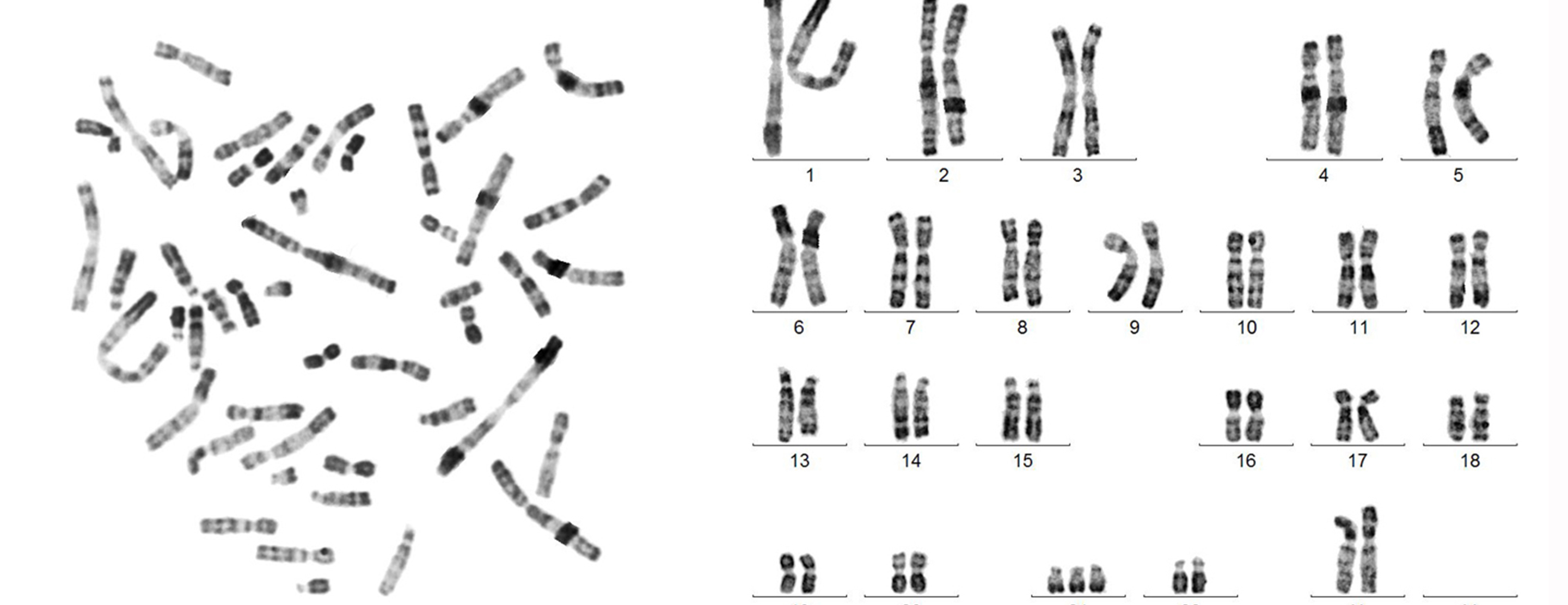 karyotyping