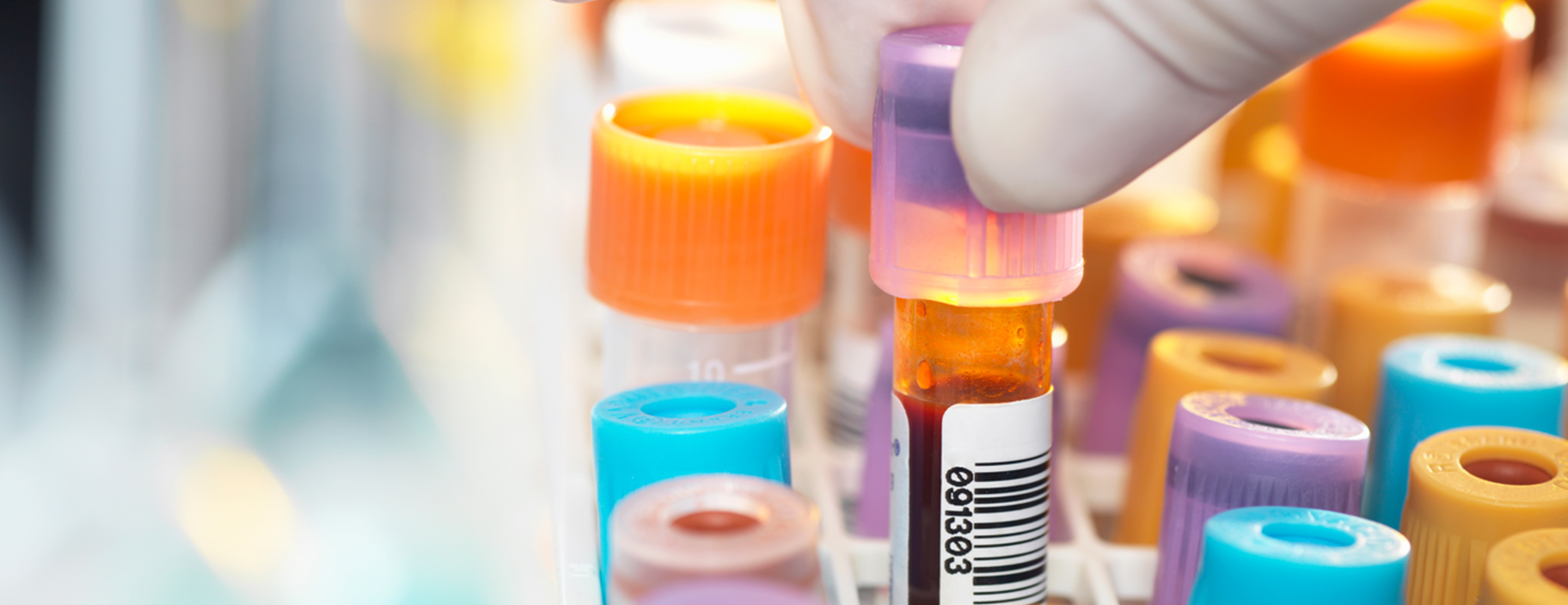 Partial thromboplastin time (PTT)