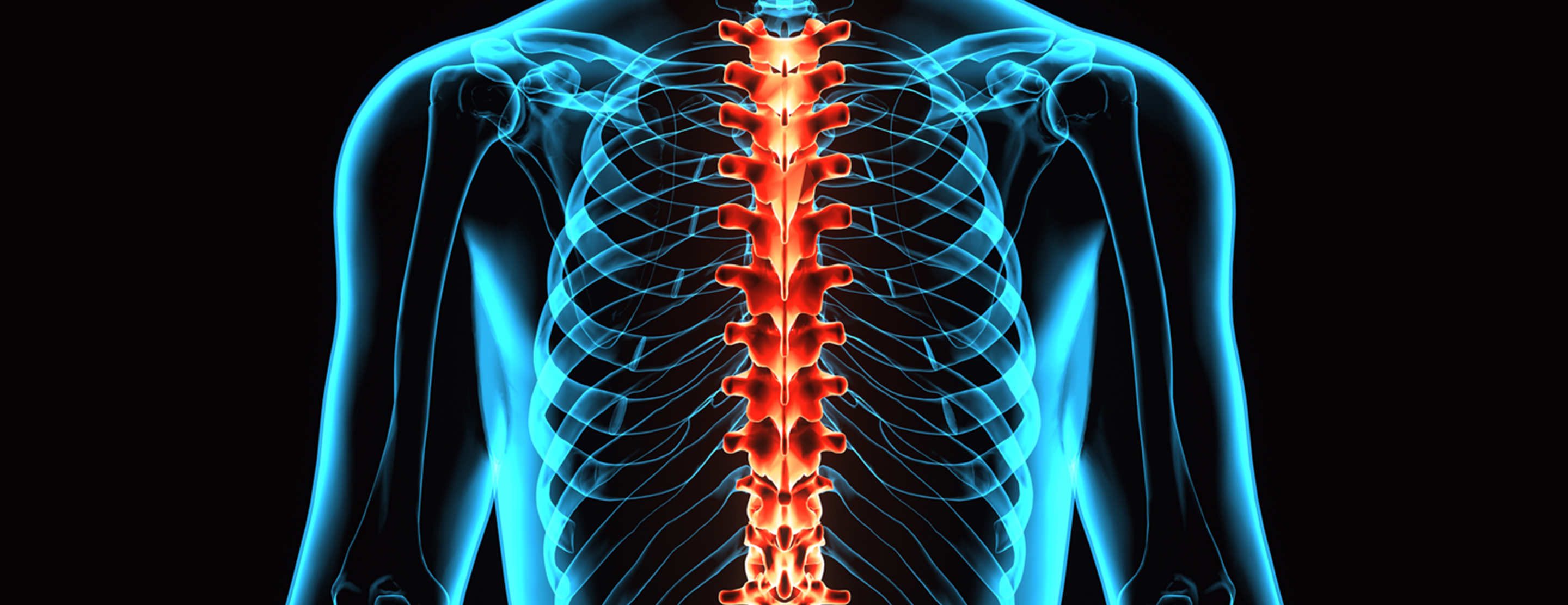 Thoracic spine x-ray