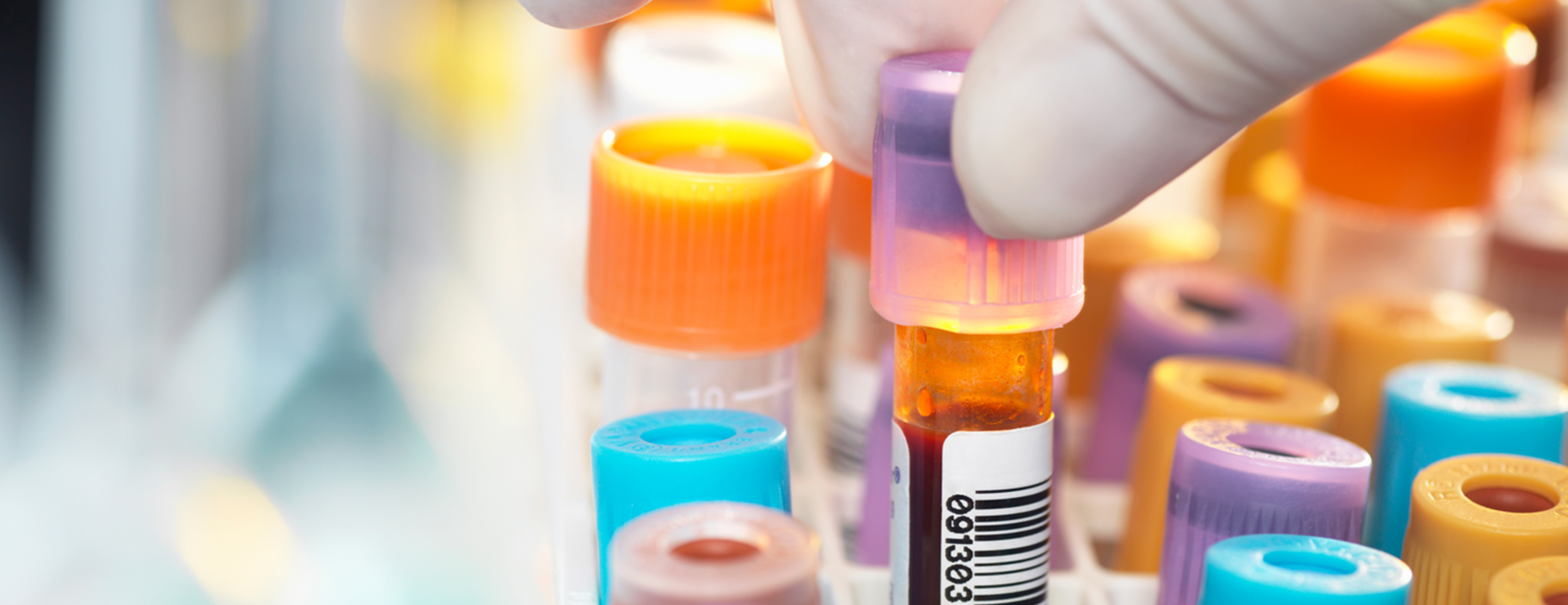 Vitamin B12 Level