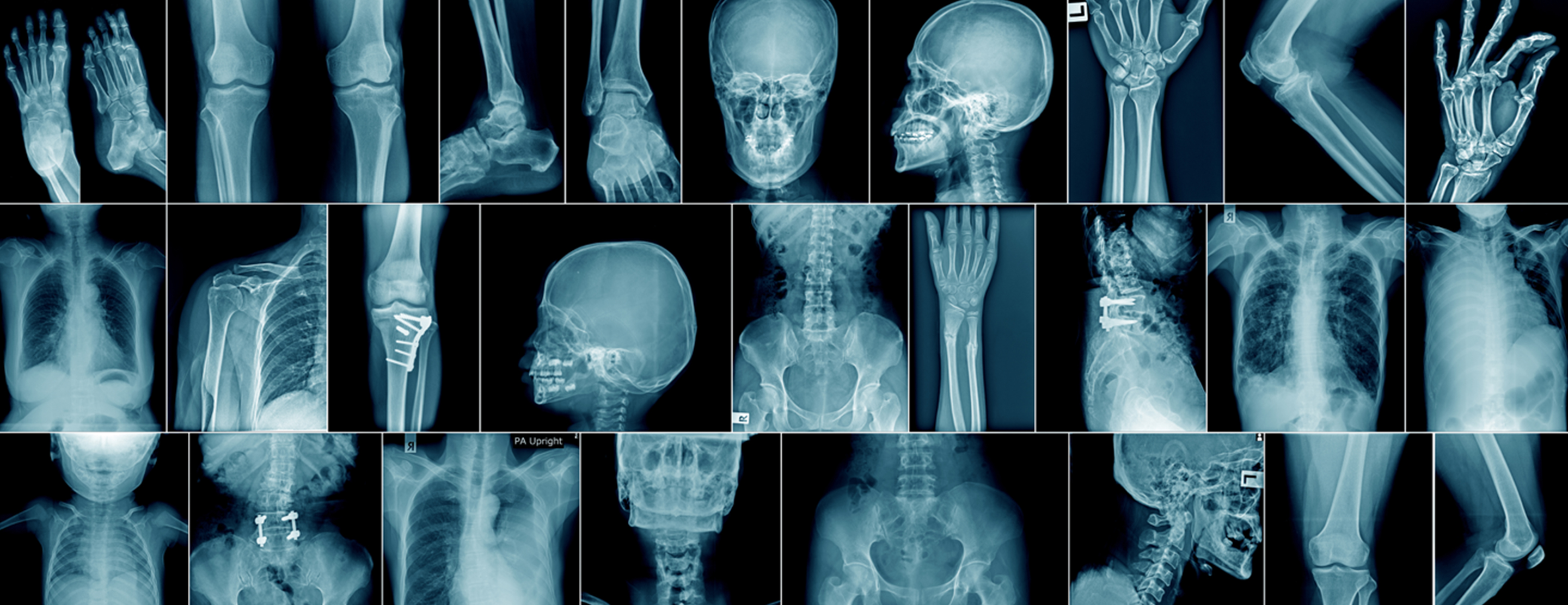 X-ray - skeleton.