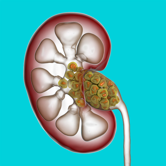 UCSF-Department-of-Urology-Research-2x