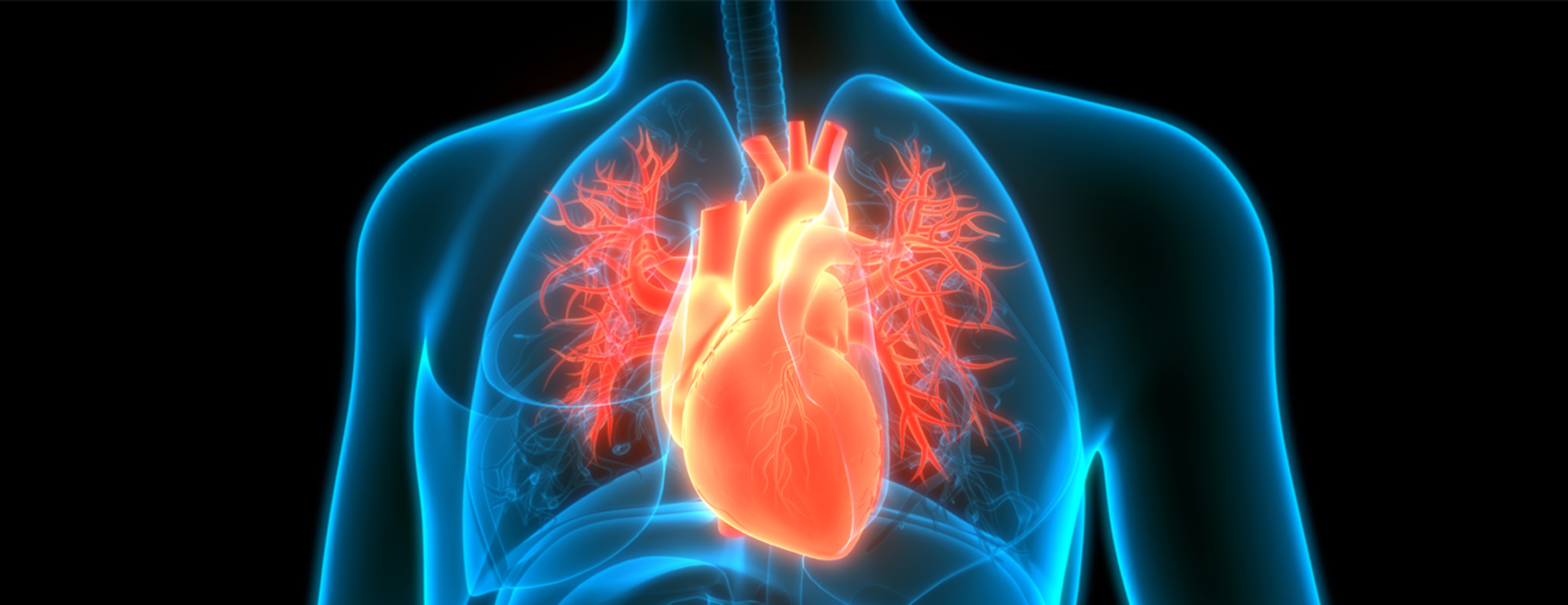 CardioMEMS | Conditions & Treatments | UCSF Health