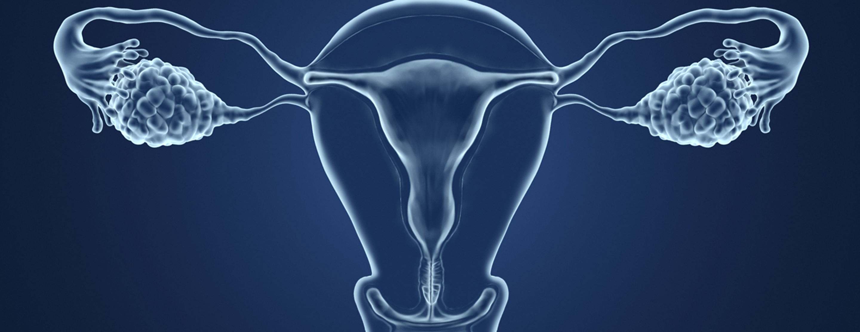 Hysterectomy | Conditions & Treatments | UCSF Health