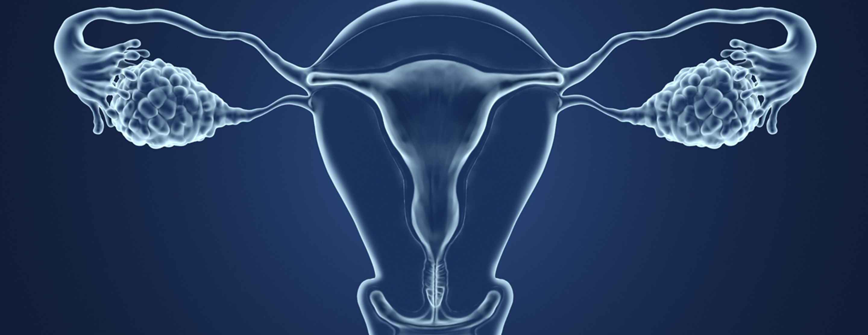 Hysterectomy Conditions Treatments UCSF Health