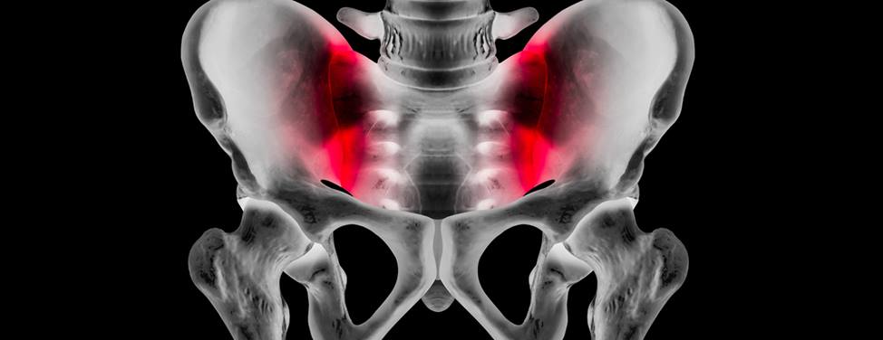 Lower back pain now treated by implantable nerve stimulation device -  UCHealth Today