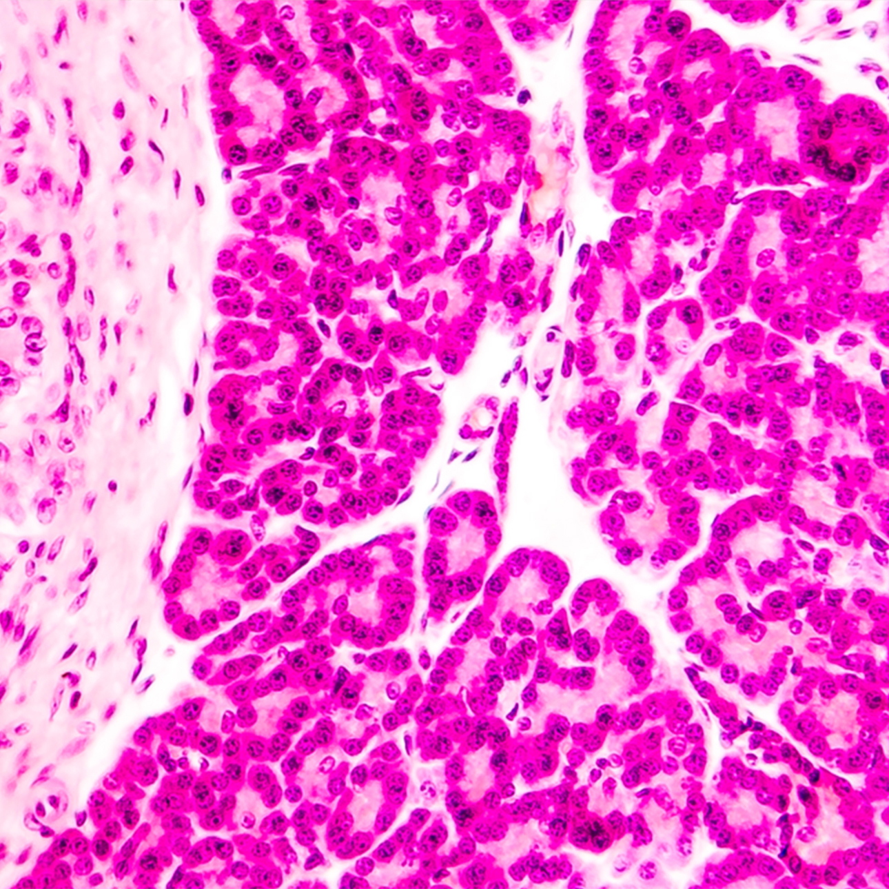 islet-transplant-for-type-i-diabetes-1290x1290