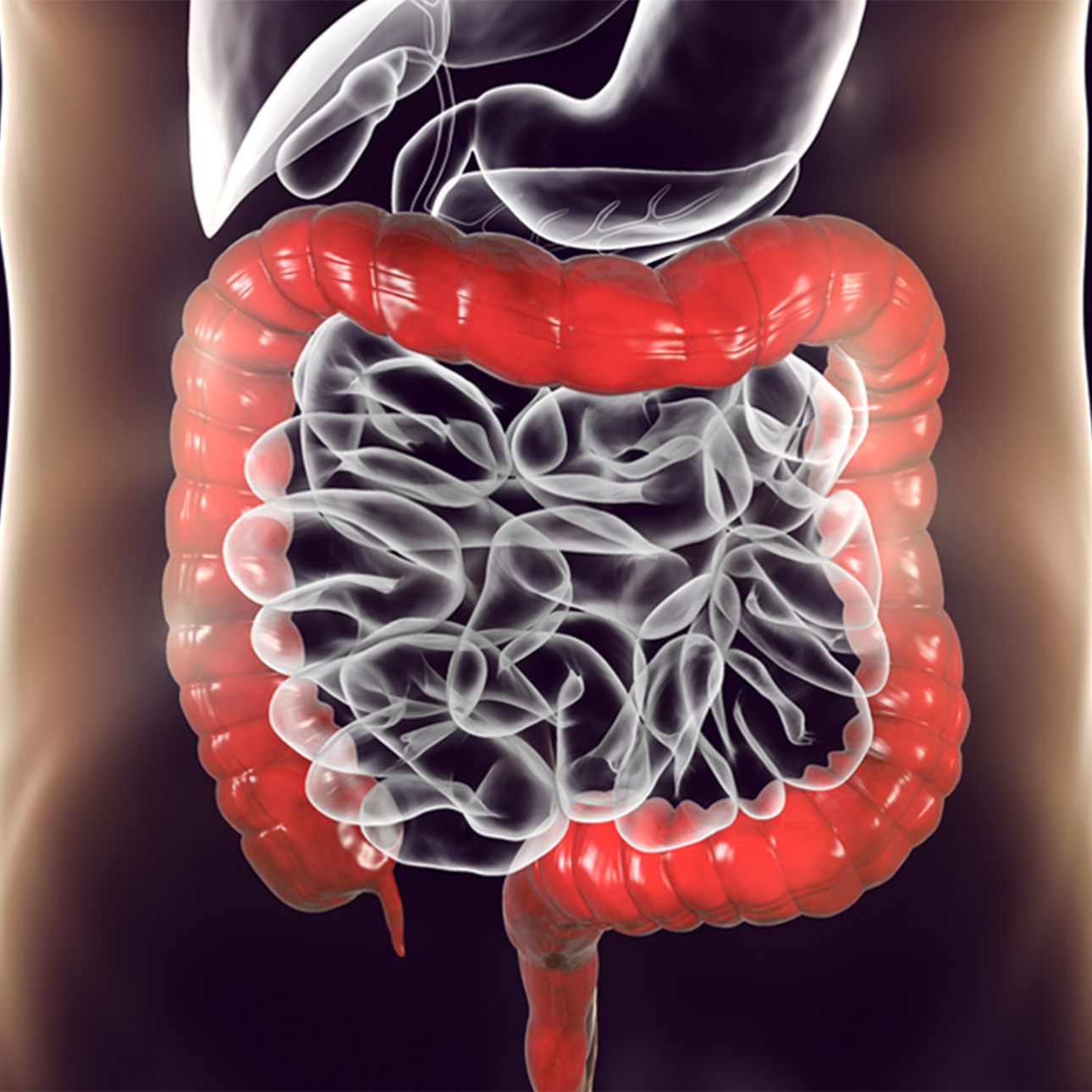 virtual-colonoscopy-1290x1290